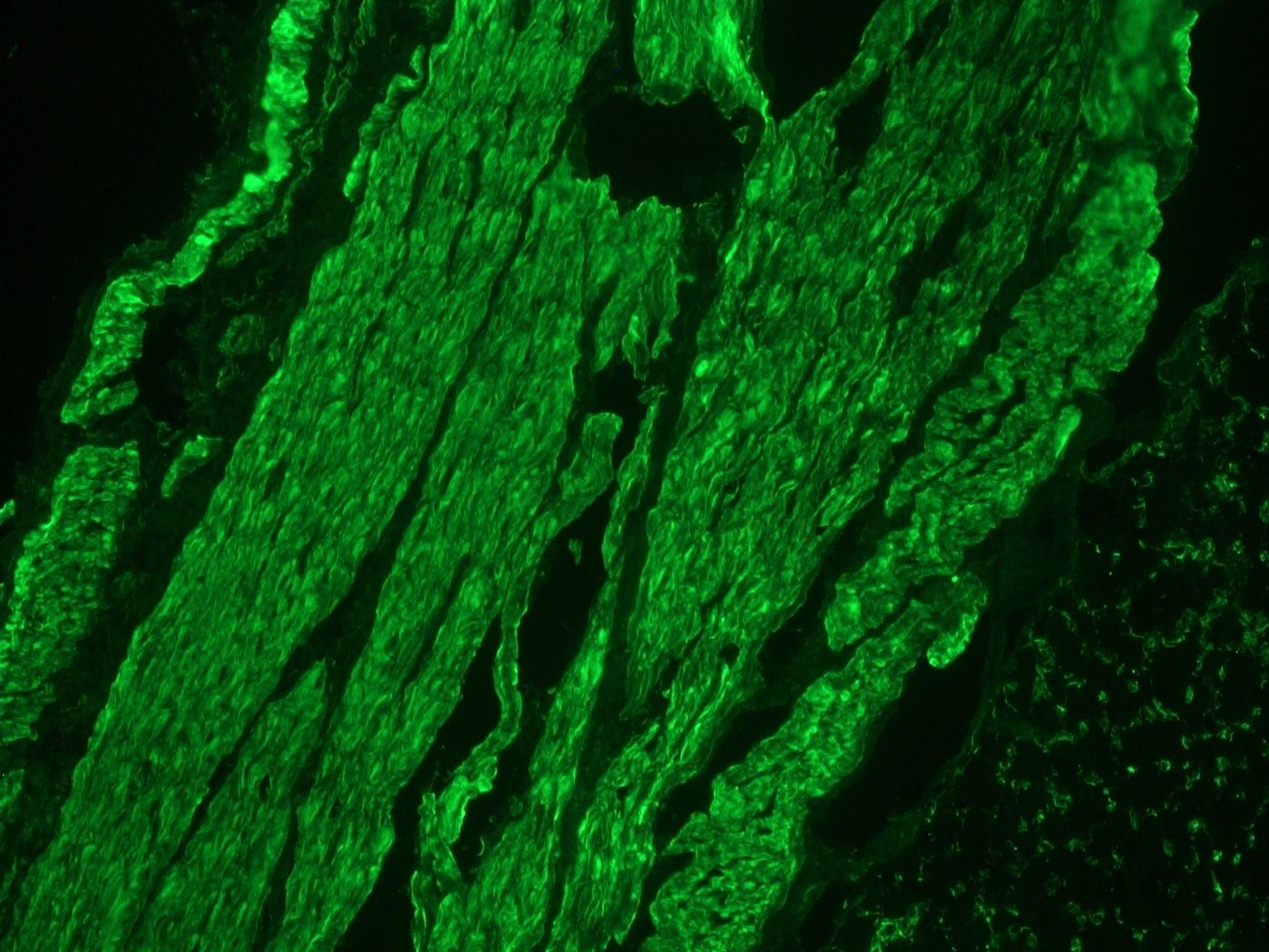 Figure 3. Muscle cell immunostaining in frozen section of chicken gizzard for desmin using MUB0402S (K5; diluted 1:200).